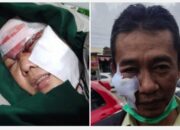 2 Orang Korban Terluka di Bagian Muka di Lempari Batu Oleh ODGJ.