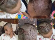 Atlet Karate Asal SMAN Sidomulyo Lamsel Gegar Otak Pengawas Tidak Bertanggung Jawab