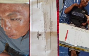 Warga Tanjung Begelung Tanggamus Diduga Dianiaya PR, Lebam di Wajah dan Pelipis