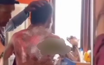 Sumbawa Gempar! Ibu Bakar Anak Kandung Gara-Gara Sulit Dibangunkan Cari Pakan Sapi