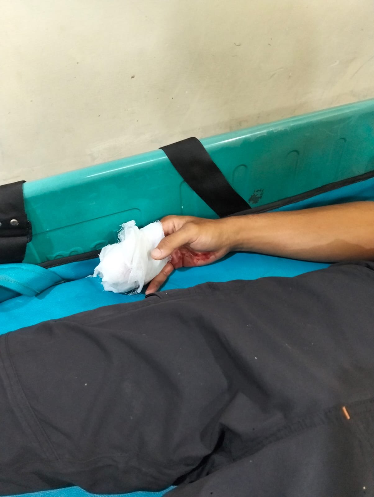 Pegawai BPBD Bandar Lampung Kehilangan 3 Jari Saat Evakuasi Banjir di Kedaton