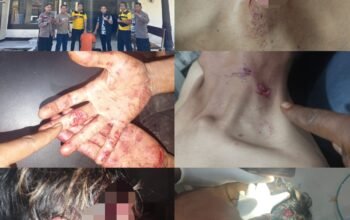 Tekab 308 Presisi Polsek Sumber Jaya Ungkap Kasus Penganiayaan, Pelaku Diamankan Kurang dari 48 Jam
